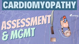 Cardiomyopathy Assessment and Management Cardiac Nursing [upl. by Hamaso610]