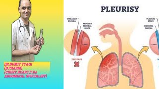 PLEURITIS DISEASES BY DRSUMIT TYAGISUMITMEDICALDISPENSARY1 [upl. by Rory]