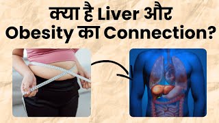 क्या है Liver और Obesity का कनेक्शन I Health Talk I OnlyMyHealth [upl. by Ahtelahs]