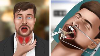 ASMR Animation Remove fish bones stuck in MrBeasts throat [upl. by Enidaj]