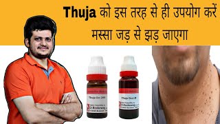 Thuja इस तरह से उपयोग करें मस्सा जड़ से झड़ जाएगा  Warts  Homeopathic Medicine  How to use [upl. by Zel571]