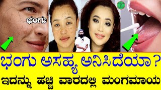 Home Remedies for Pigmentation  Bhangu on Face Kannada  Pigmentation Cream  Glowing Skin [upl. by Mikeb]