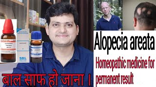 Homeopathic medicine for Alopecia areata  explain everything  permanent result [upl. by Eilsel306]