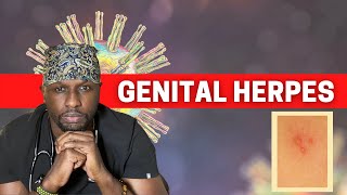 The Truth About Genital Herpes Complete Guide [upl. by Aihtebat]