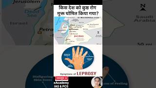 किस देश को कुष्ठ रोग मुक्त घोषित किया गया leprosyfree who jordan NationalAntiLeprosyDay [upl. by Aruam]