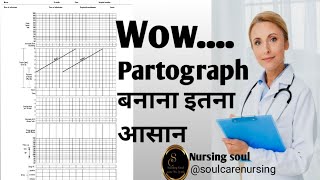 Partograph कैसे भरें Partograph in Labour in HindiPartograph plottingmidwiferylabourdelivery [upl. by Koerner]