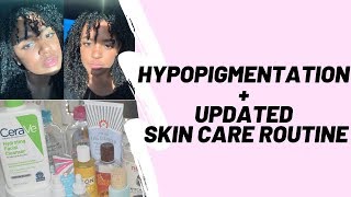 Hypopigmentation  Updated Skin Care Routine  OMRISKINZ [upl. by Ahsitan]