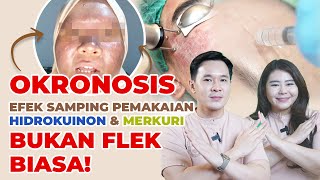 OKRONOSIS  EFEK SAMPING PEMAKAIAN HIDROKUINON amp MERKURI BEDA DENGAN FLEK BIASA [upl. by Simmons]