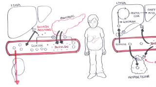 Diabetes Type II Pathophysiology [upl. by Solegna394]