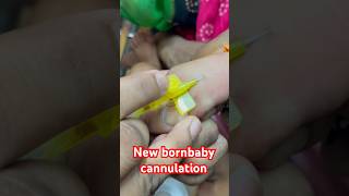 Newborn 👶 baby 👶 cannulation  cannulation shorts trending new SMpharmacy plz subscribe [upl. by Llenrup]