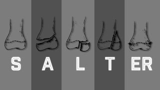 Salter Harris Fracture Classification  MEDZCOOL [upl. by Funk359]