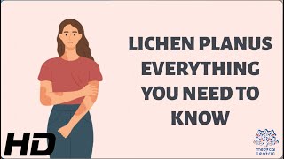 Unlocking the Mystery of Lichen Planus  Everything You Need to Know [upl. by Akaenahs]