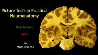 Picture Test in Neuroanatomy Brain Sections 2 [upl. by Aekahs]