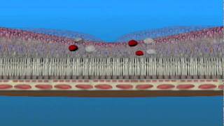 Edema Macular y Isquemia Macular [upl. by Waldner]