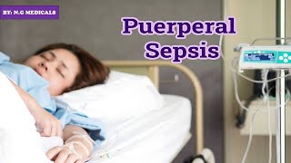 puerperal sepsis part 1 NGMedicals [upl. by Mattox]