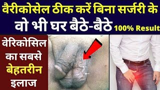 वैरीकोसेल ठीक करें बिना सर्जरी के  Vericocele Natural Treatment By Homeopathy  Andkosh May Derd [upl. by Nallad]