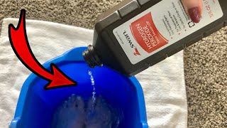 Put Hydrogen Peroxide on your FEET amp SEE WHAT HAPPENS 💥 this is cool and surprising [upl. by Oiludbo]