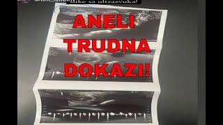 ANELI TRUDNA DOKAZI CRNO NA BELO zadruga uzivo [upl. by Rumit]