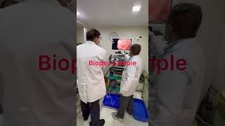 UPPER GI Endoscopy EsophagoscopyGASTROSCOPY Duodenoscopymbbs medical doctor byDr Raj mishra [upl. by Darnall]