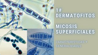 Micosis superficiales  1  Dermatofitos  Trichophyton  Epidermophyton  Microsporum [upl. by Ainaled574]