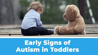 Detecting Autism in Your Toddler  Look for These Signs [upl. by Joya155]