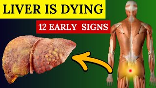 12 Strange Signs of LIVER DAMAGE [upl. by Maighdiln]