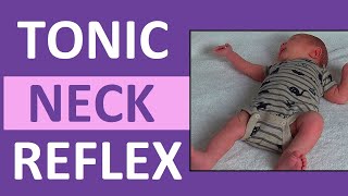 Tonic Neck Reflex in Infant Newborn  Pediatric Nursing Newborn Assessment [upl. by Assilav]