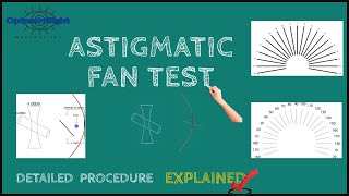 Astigmatic Fan Test Detailed Procedure and Principle Explained [upl. by Kowtko]