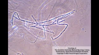 Microsporum ferrugineum identification [upl. by Alwitt]