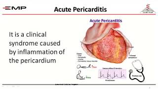 pericardial diseases By DrAdel Shabana [upl. by Beitz253]