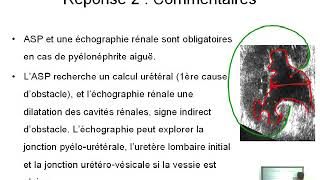 Dossier PAE  Urologie 02 [upl. by Everard]