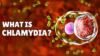 Chlamydia STI – Causes Signs and Symptoms Diagnosis amp Treatment [upl. by Beebe]