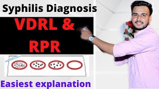 VDRL amp RPR TEST  VDRL TEST IN HINDI  SYPHILIS DIAGNOSIS TESTS [upl. by Feer]