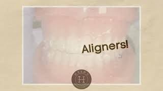 How To Identify Your Clear Aligners  Invisalign amp Braces Teens amp Adults  Rockford MI [upl. by Mercado]