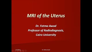 13 Female Pelvis 1  Uterus  Prof Dr Fatma Awad [upl. by Nosraep]