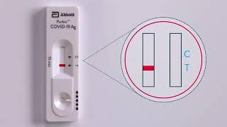 Panbio™ COVID 19 Ag Nasal Swab Procedure Live Action [upl. by Ardith674]