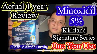 Minoxidil 5 Kirkland Signature 😱 One Year Review [upl. by Alejna]