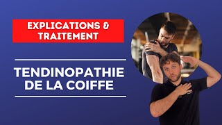 Nouvelles approches de rééducation pour une TENDINOPATHIE de la COIFFE  Explications amp traitement [upl. by Eisak]