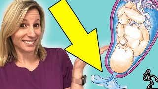 WHAT TO DO WHEN YOUR WATER BREAKS  BEST ADVICE for Pregnant Moms with Leaking Amniotic Fluid [upl. by Etra37]