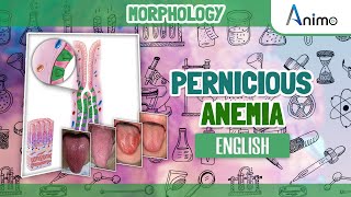 Pernicious Anemia  Histo pathology  RBC Morphology  English [upl. by Onifled843]