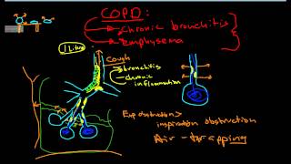 Pathophysiology of COPD [upl. by Heyward608]