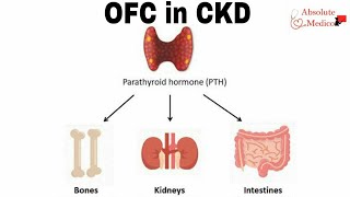 Osteitis Fibrosa Cystica in Chronic Kidney Disease  Part 1 [upl. by Nyltiac]