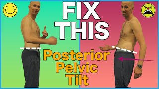 FIX Posterior Pelvic Tilt with 2 Exercises [upl. by Calore543]