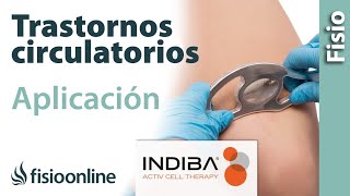 Falta de riego edema trombosis… Aplicación de INDIBA ACTIV en los trastornos circulatorios [upl. by Yenalem]