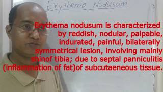 Erythema nodosum  panniculitis Definition Cause Pathology Clinical featureTreatment [upl. by Metabel868]