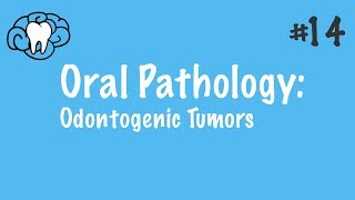 Oral Pathology  Odontogenic Tumors  INBDE ADAT [upl. by Giarla]