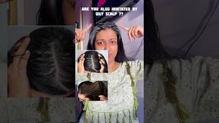 Tips for Oily Irritated Scalp  Itchy Oily Scalp haircare [upl. by Enilesoj]