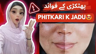 How To Get Clear Skin😳 l Benefits of Phitkari To Remove Pigmentation Dark Spots Pimples skincare [upl. by Trumann112]