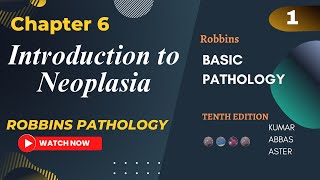 Introduction to Neoplasia  Neoplasia Lectures Chapter 6 Robbins Basic Pathology Lecture 1 [upl. by Leihcey251]