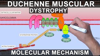 Duchenne Muscular Dystrophy [upl. by Lianna824]